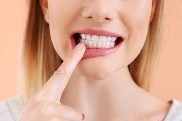 Самые вредные продукты, которые вредят белизне зубов